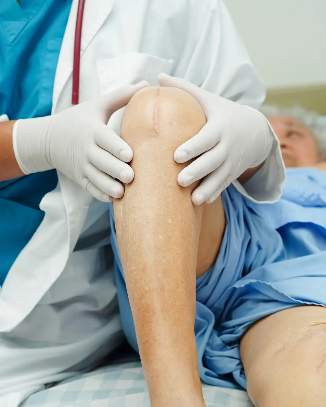 Knee Replacement Surgery through Robots in India (2025) - It is All You Need to Know