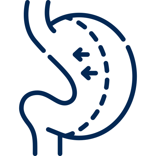 Bariatric Surgery
